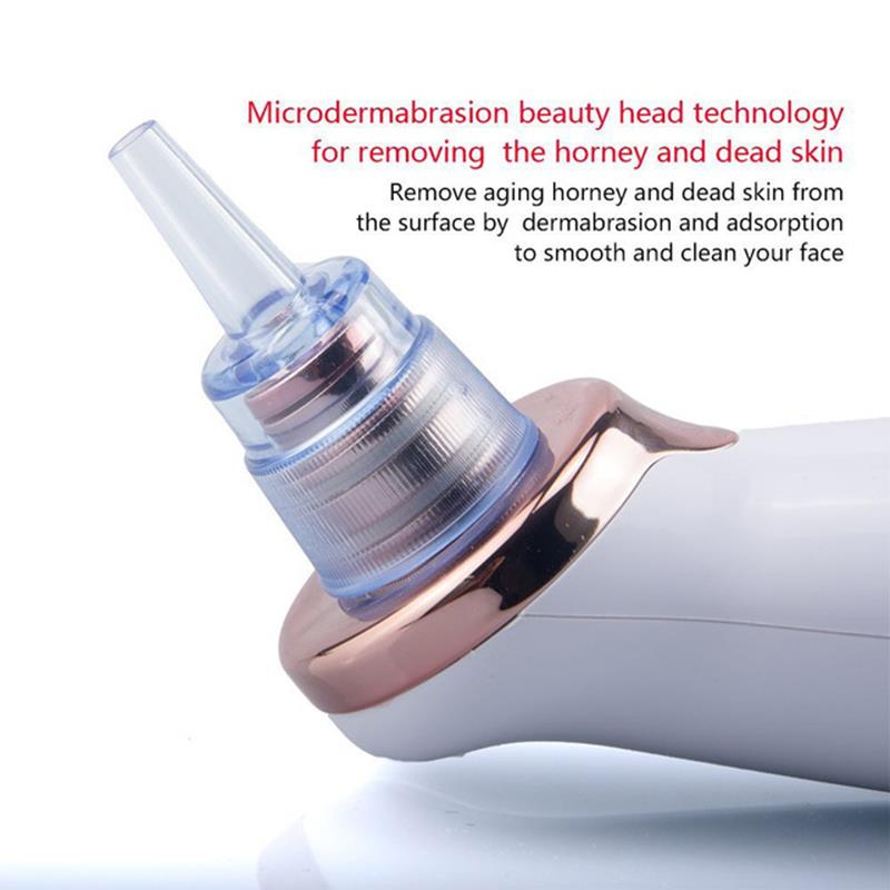 Facial Blackhead Remover Electric Acne Cleaner - magsofter
